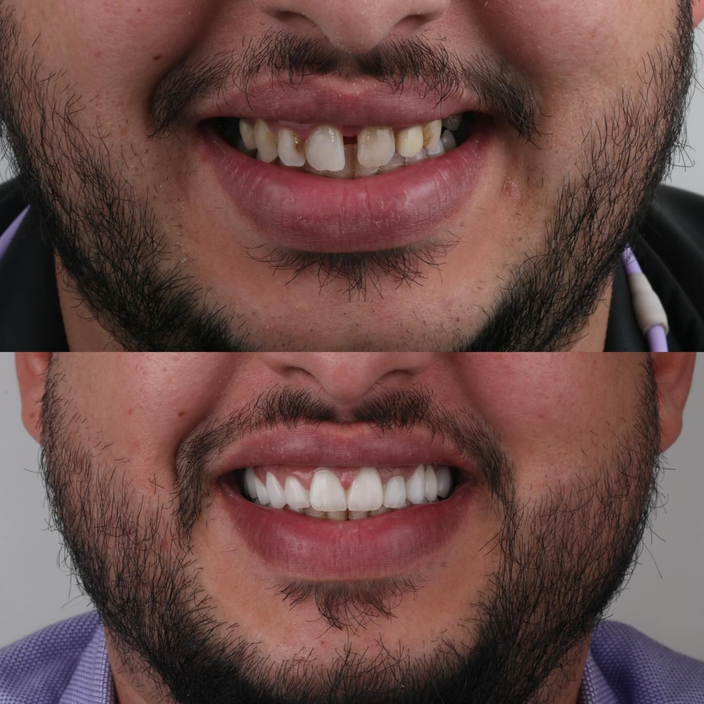 Transformation 3