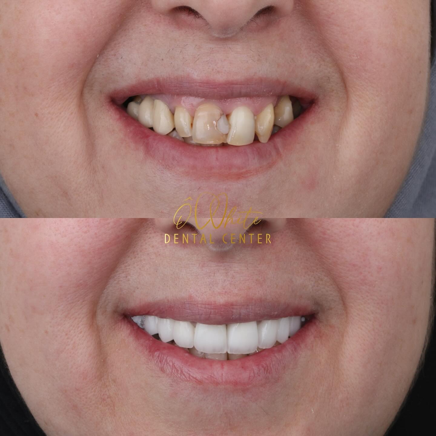 Transformation 4