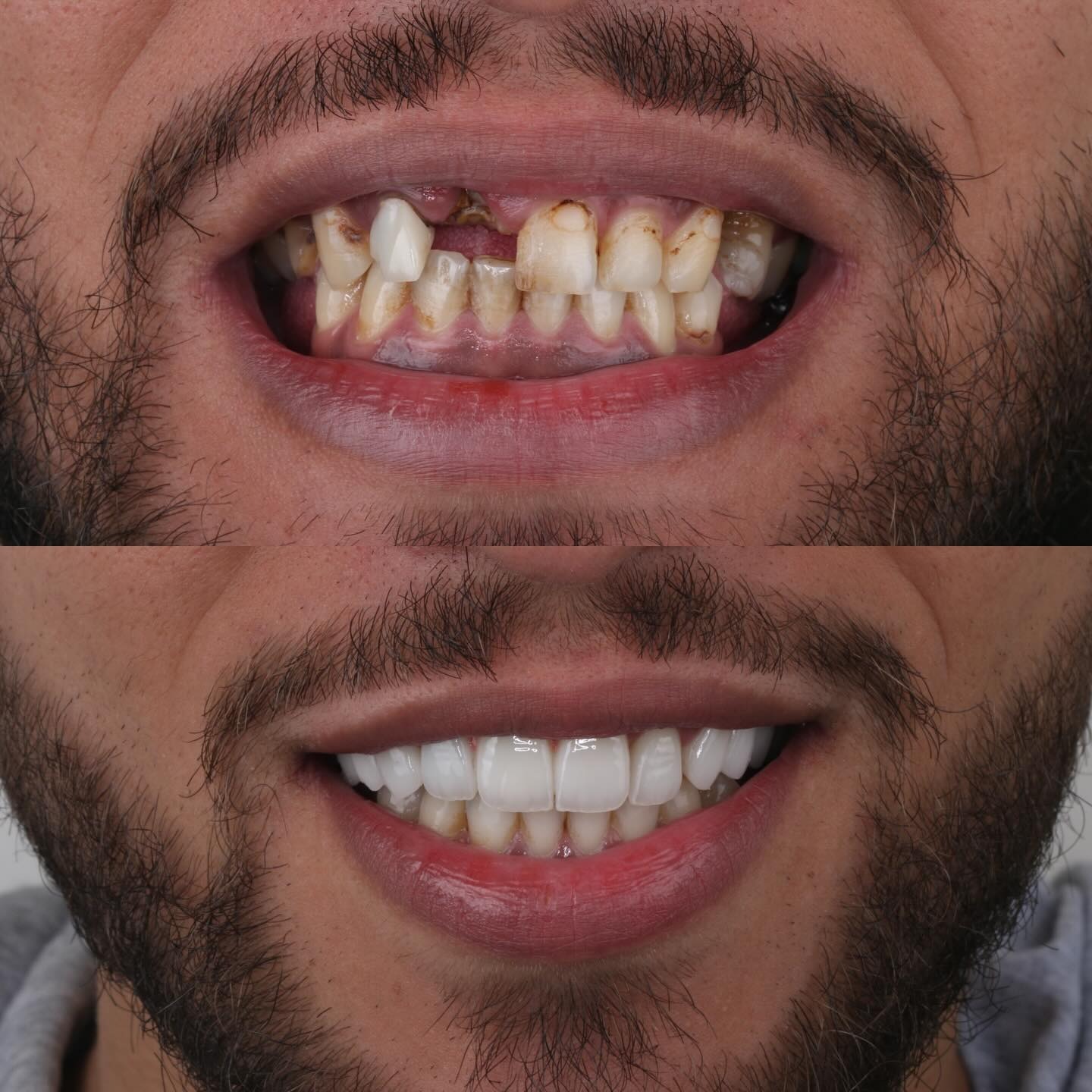 Transformation 5