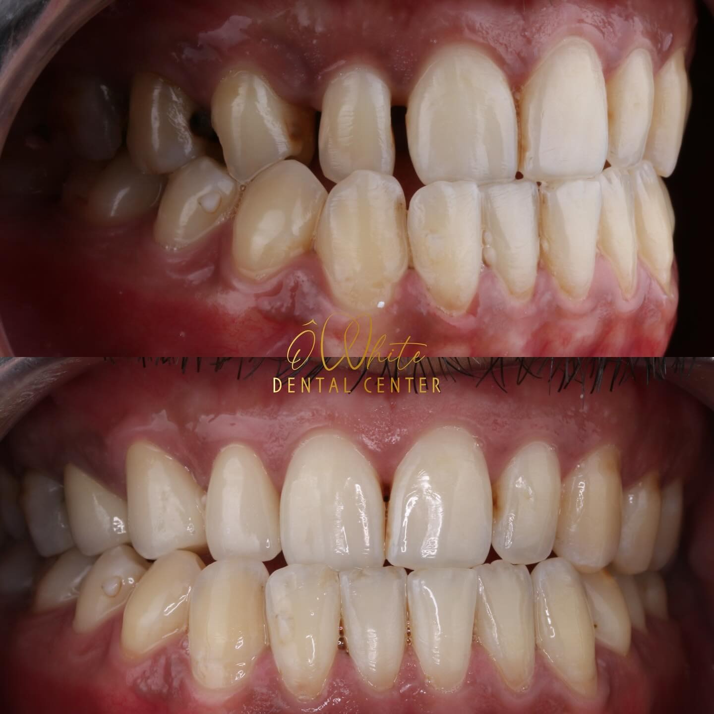Transformation 6